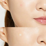 COSRX - Acne Pimple Master Patch - GA HEADHOUSE
